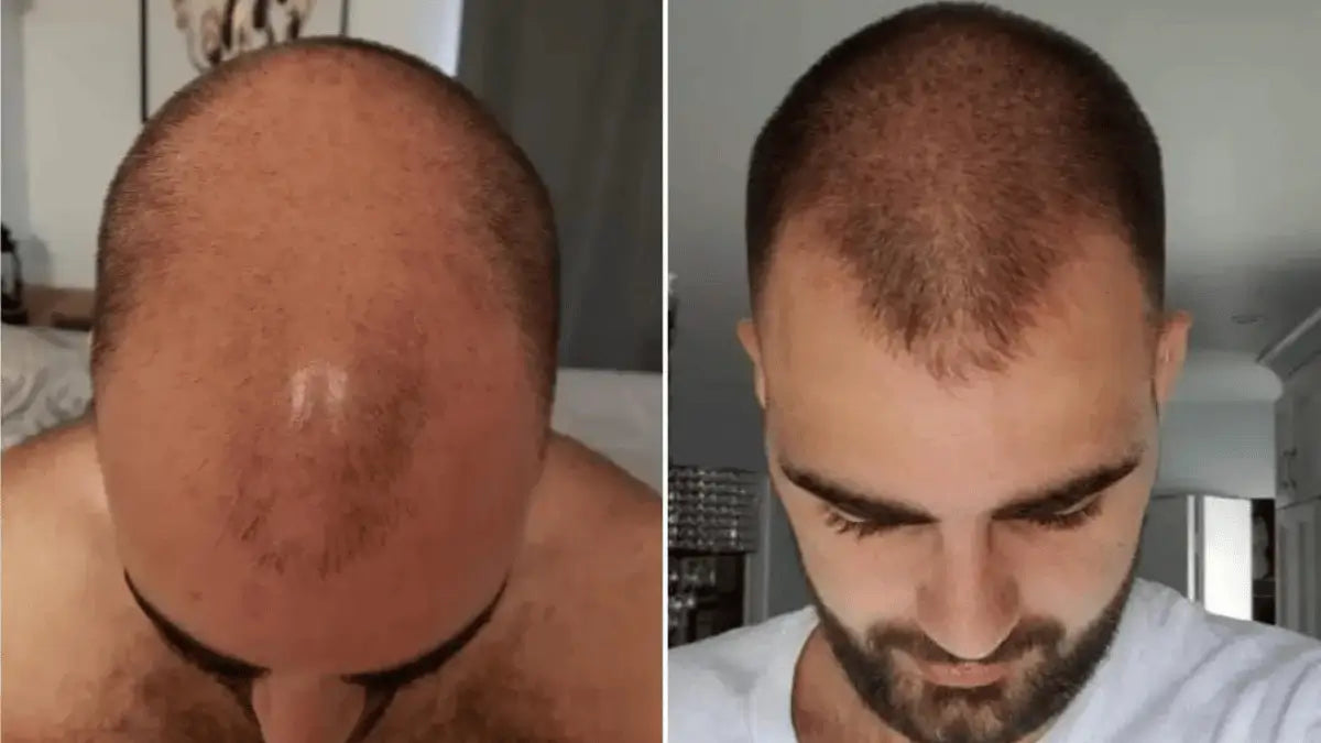 SADOER® ¡Recupera y reduce la caída de tu cabello! (500ml)