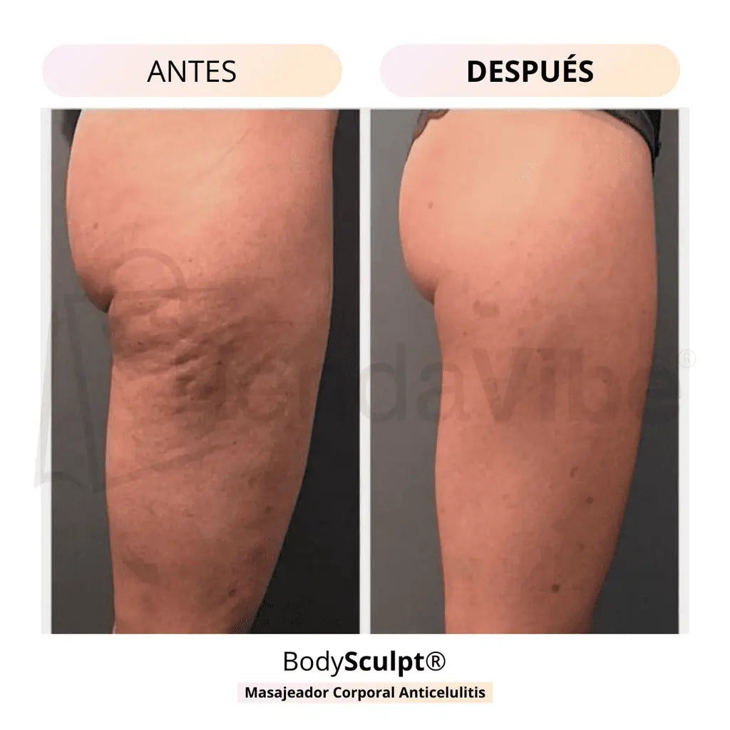 BodySculpt® Masajeador Anti-celulitis + Electro Estimulador de Gluteos GRATIS