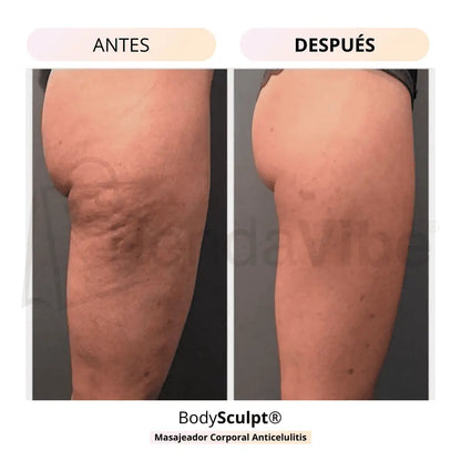 BodySculpt® Masajeador Anti-celulitis + Electro Estimulador de Gluteos GRATIS